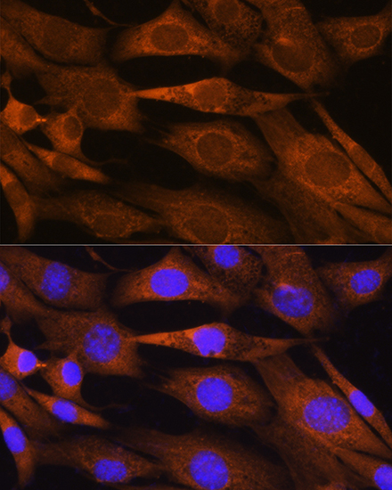 Anti-PHOSPHO2 Antibody (CAB12816)