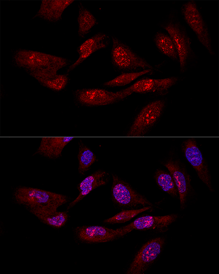 Anti-EIF6 Antibody (CAB1818)