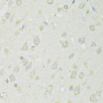 Anti-SLC22A5 Antibody (CAB14785)