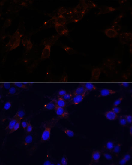 Anti-CD44 Antibody (CAB16807)