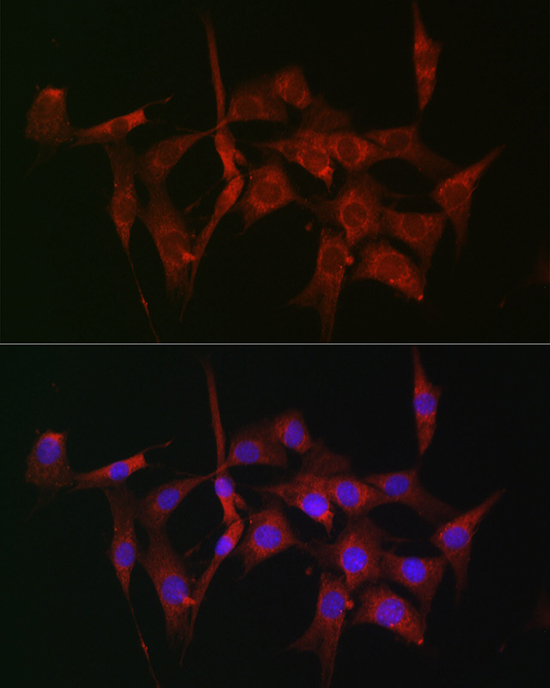 Anti-FSCN1 Antibody [KO Validated] (CAB1904)