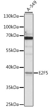 Anti-E2F5 Antibody (CAB16042)