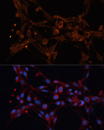 Anti-ALDH6A1 Antibody (CAB14750)