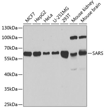 Anti-SARS Antibody (CAB13350)