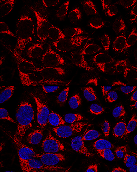 Anti-OCIAD1 Antibody (CAB11630)