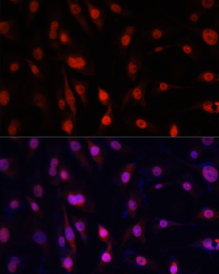 Anti-YBX1 Antibody (CAB15696)