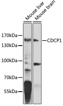 Anti-CDCP1 Polyclonal Antibody (CAB8254)