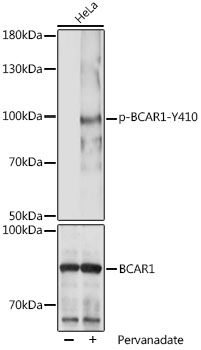 Anti-Phospho-BCAR1-Y410 Antibody (CABP1058)