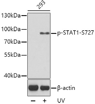 Anti-Phospho-STAT1-S727 Antibody (CABP0453)