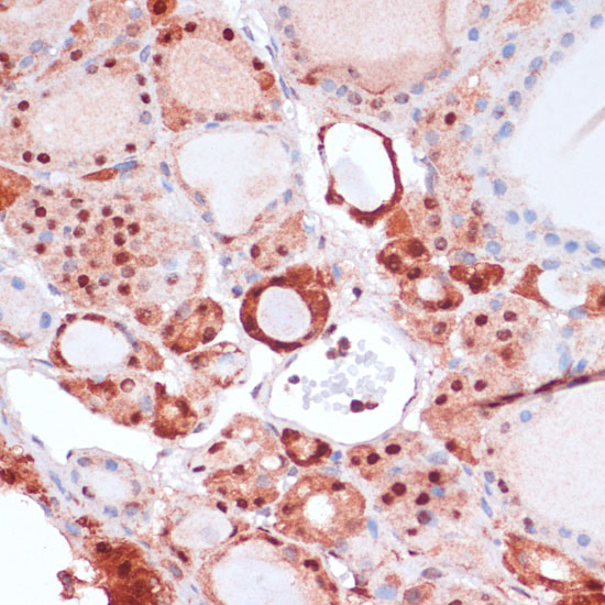 Anti-S100A5 Antibody (CAB14779)