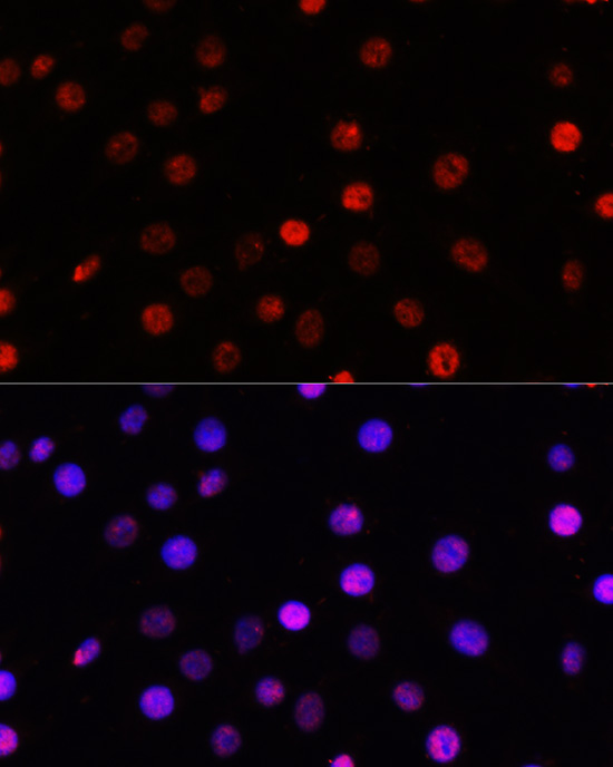 Anti-TCF4 Antibody (CAB1141)