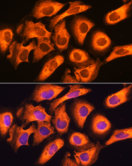 Anti-RIG-I / DDX58 Antibody (CAB13407)