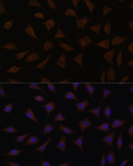 Anti-CDKN2A / p16INK4a Antibody (CAB11058)