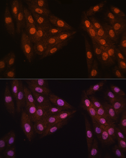 Anti-MAD2L2 Antibody (CAB12559)