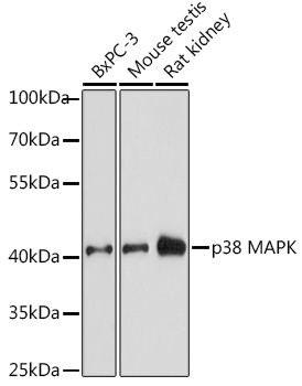 Anti-p38 MAPK Antibody [KO Validated] (CAB14401)
