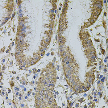 Anti-MTIF3 Polyclonal Antibody (CAB8524)