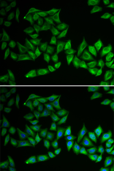 Anti-TPMT Antibody (CAB14067)