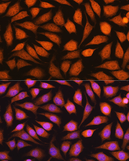 Anti-YWHAE Antibody (CAB1058)