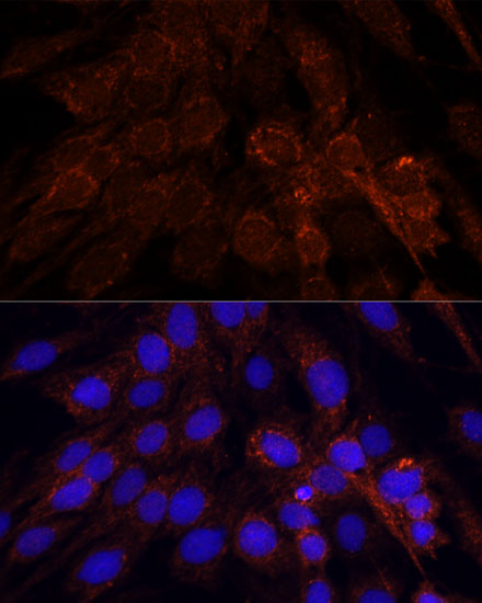 Anti-POLRMT Antibody (CAB15605)