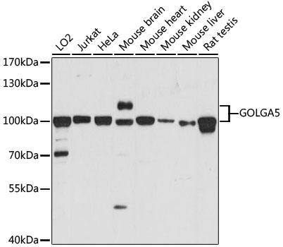 Anti-GOLGA5 Antibody (CAB15768)