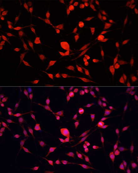 Anti-YBX1 Antibody (CAB15696)