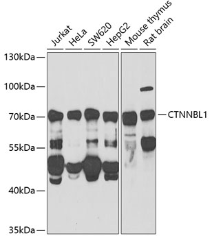 Anti-CTNNBL1 Antibody (CAB6572)