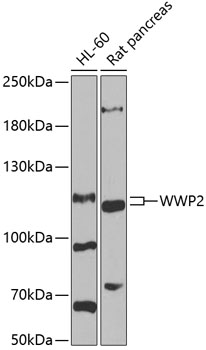 Anti-WWP2 Antibody (CAB6789)