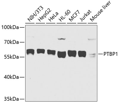 Anti-PTBP1 Antibody (CAB6107)