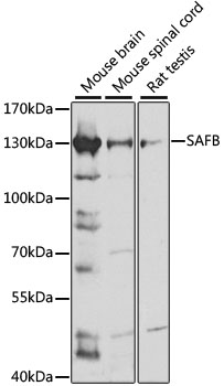 Anti-SAFB Antibody (CAB15721)