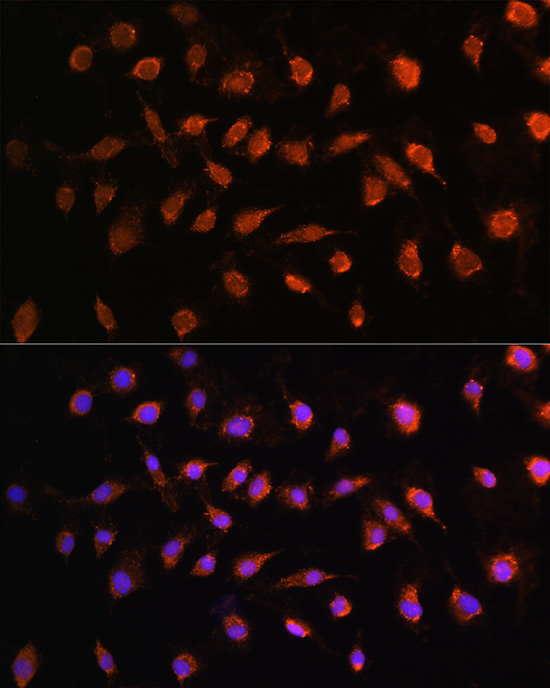 Anti-STK38 Polyclonal Antibody (CAB8191)