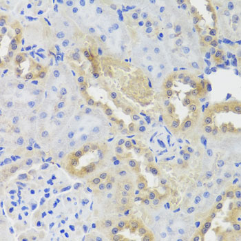 Anti-CTSC Polyclonal Antibody (CAB8403)