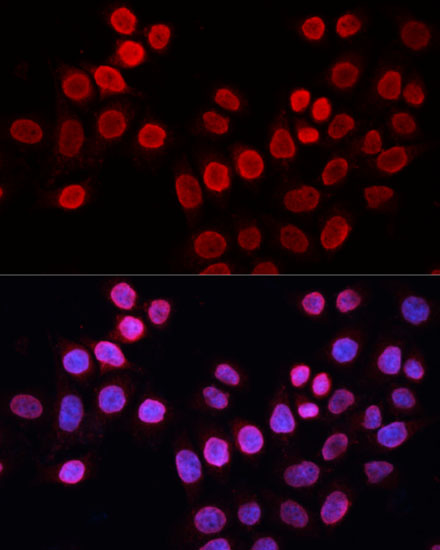 Anti-ERCC5 Antibody (CAB1605)