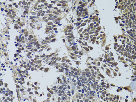 Anti-LKB1 Antibody [KO Validated] (CAB2122)