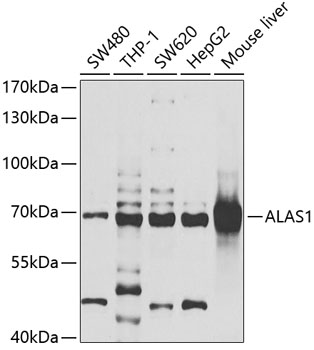 Anti-ALAS1 Antibody (CAB6521)