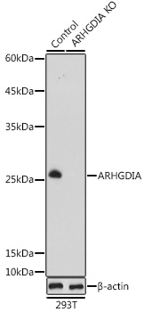 Anti-ARHGDIA Antibody [KO Validated] (CAB13468)