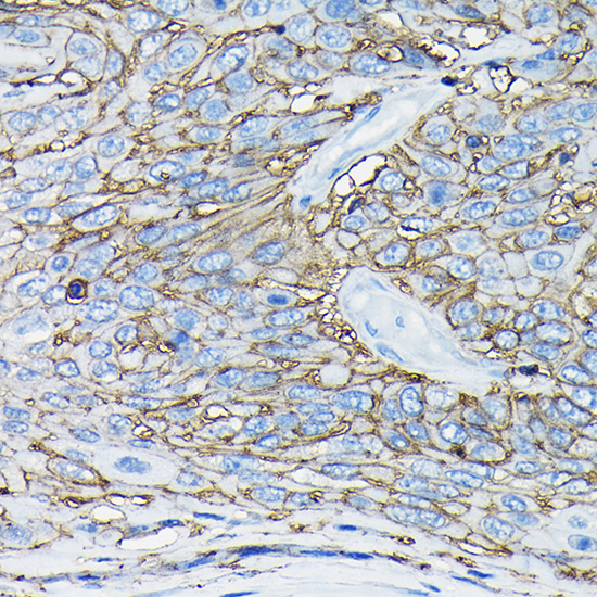 Anti-CD98 Antibody [KO Validated] (CAB19880)