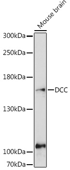 Anti-Netrin receptor DCC Polyclonal Antibody (CAB9372)