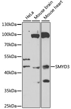 Anti-SMYD3 Antibody (CAB7309)