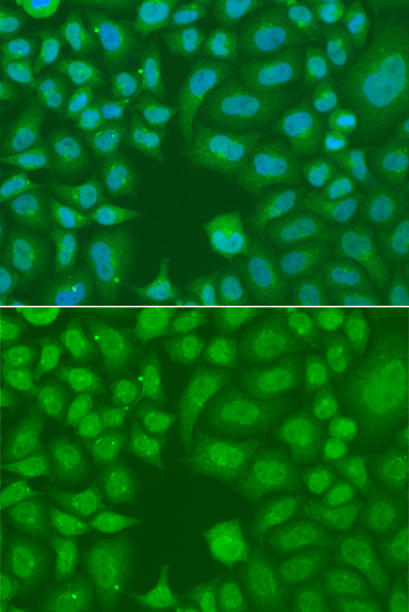 Anti-AES Antibody (CAB7874)