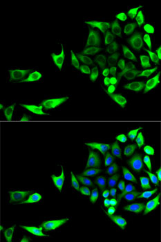 Anti-GOT1 Antibody (CAB5822)