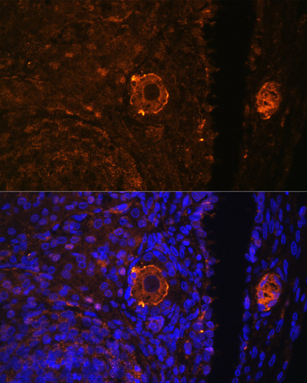 Anti-ZP3 Polyclonal Antibody (CAB8355)