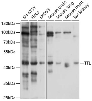 Anti-TTL Antibody (CAB10027)