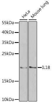 Anti-IL-18 Antibody [KO Validated] (CAB1115)