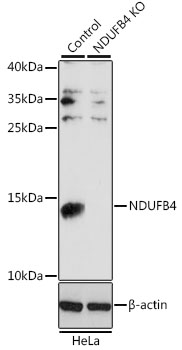 Anti-NDUFB4 Antibody [KO Validated] (CAB13820)