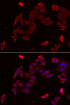 Anti-PDHX Antibody (CAB6426)