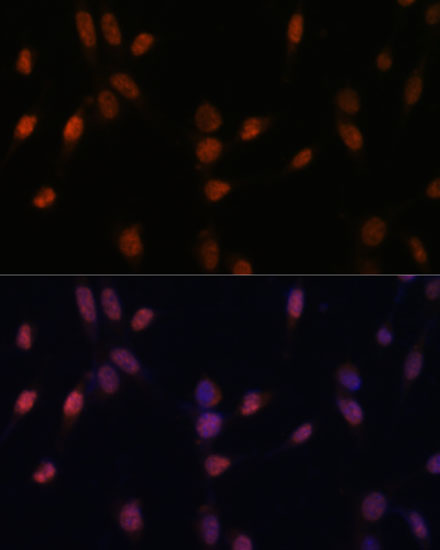 Anti-USP33 Antibody (CAB16187)