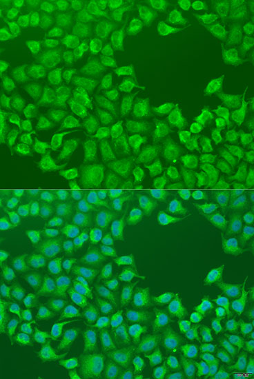 Anti-CEP57L1 Polyclonal Antibody (CAB8290)