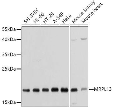 Anti-MRPL13 Antibody (CAB5979)