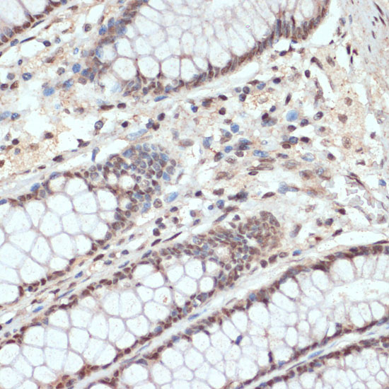 Anti-Phospho-AKT1-S473 Antibody (CABP0140)