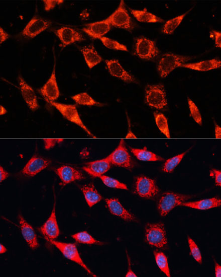 Anti-PDHA2 Polyclonal Antibody (CAB9943)